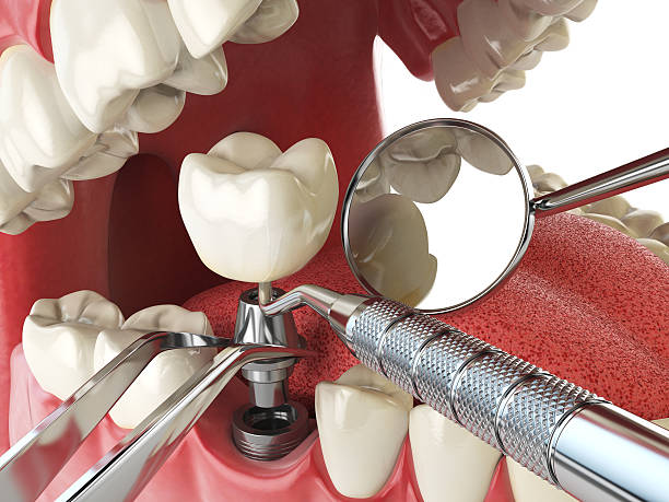 Best Emergency Denture Repair in Medicine Lodge, KS